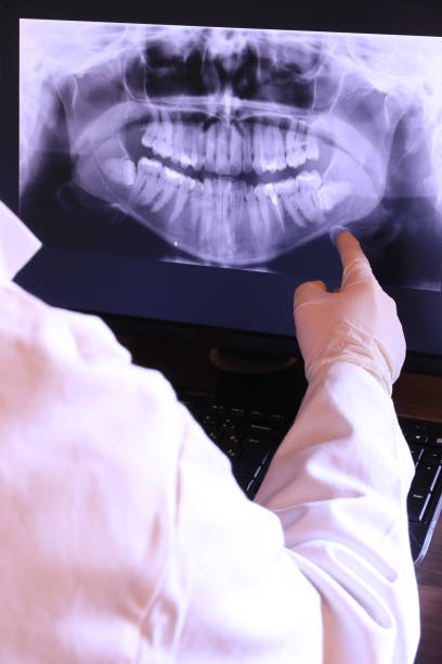 Best Emergency Wisdom Teeth Removal in Stockton, UT